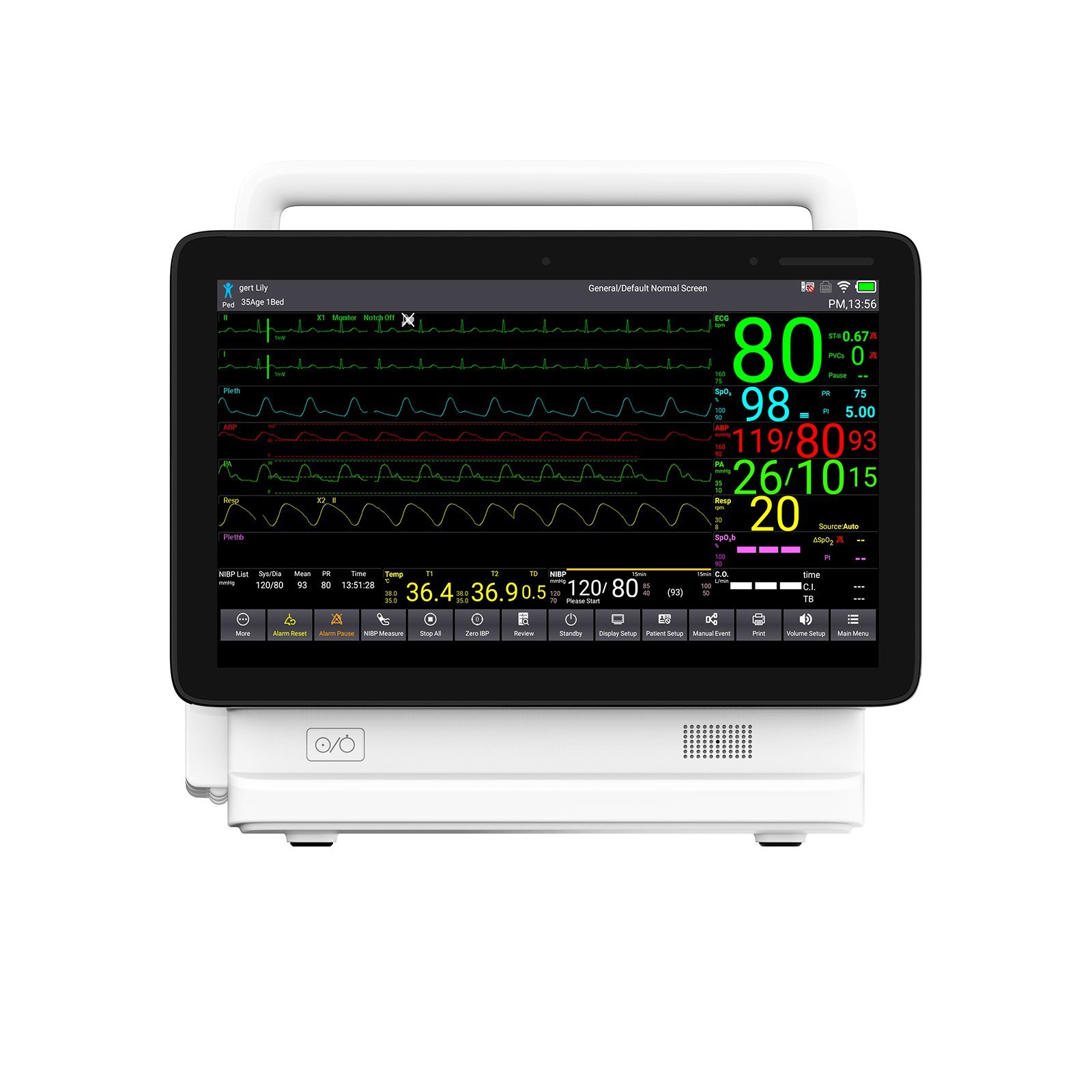 Patient Monitor